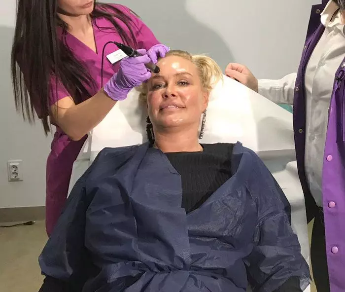 Tratamentul minune pentru față pe care îl face Vica Blochina. Efectele durează luni de zile