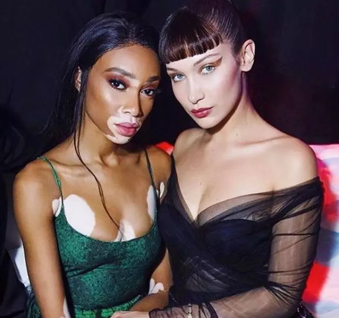 Winnie Harlow, cel mai frumos model cu vitiligo