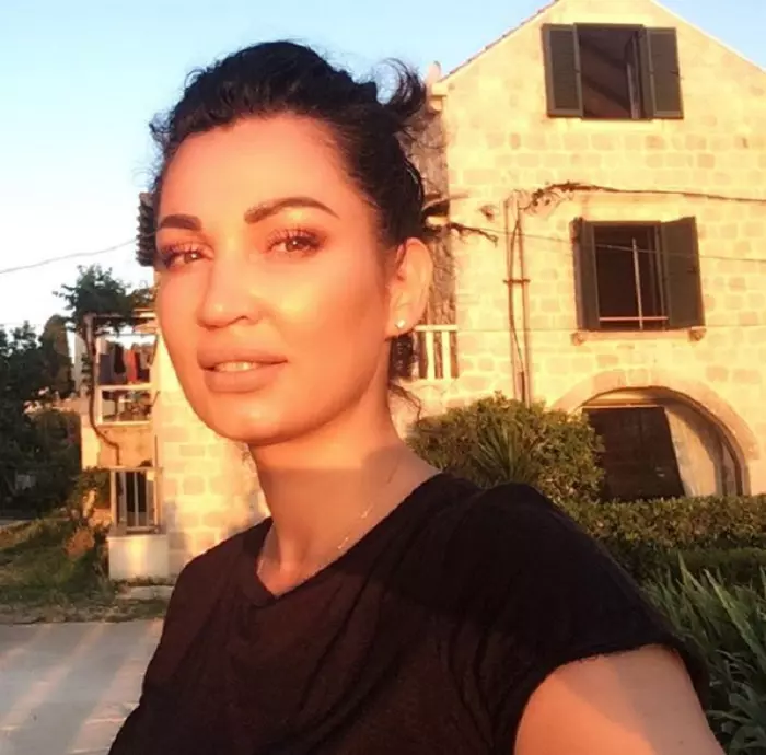 Nicoleta Luciu interventii estetice 8