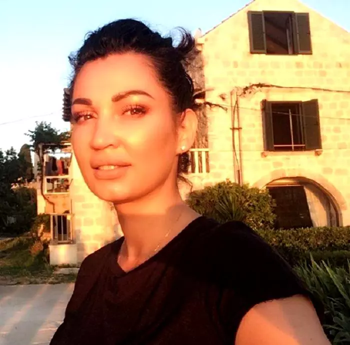 Nicoleta-Luciu-interventii-estetice-8