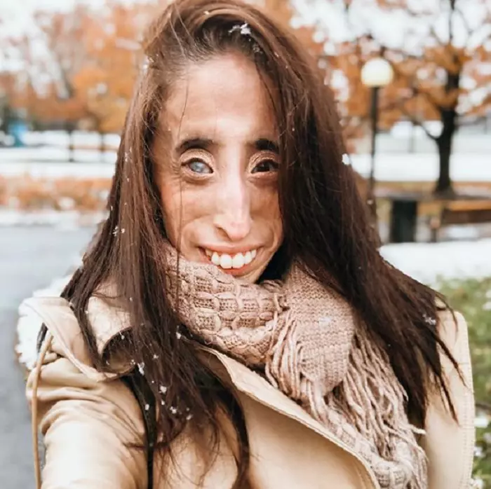 Lizzie Velasquez