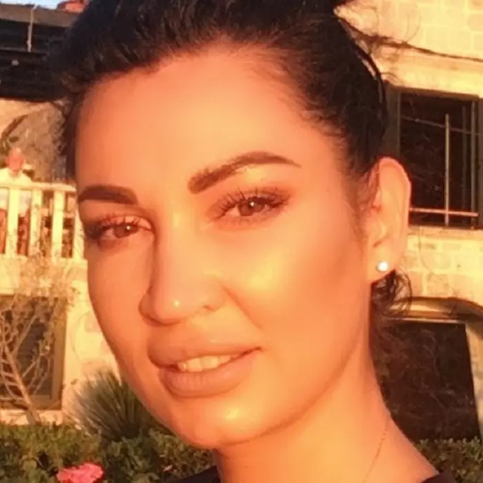 Nicoleta Luciu interventii estetice 6