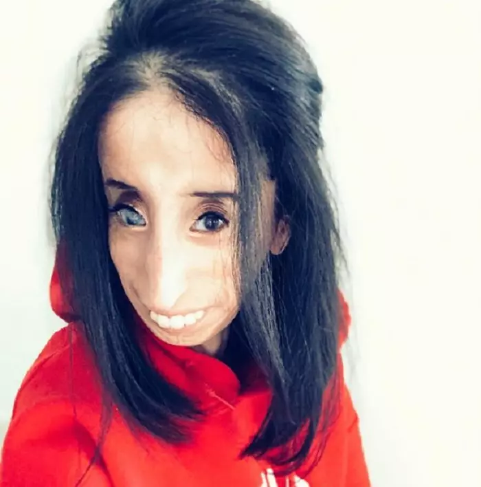Lizzie Velasquez