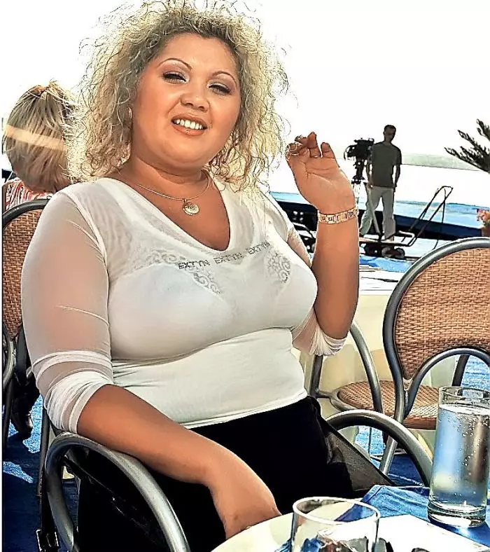 Minodora înainte de operația de micșorare a stomacului