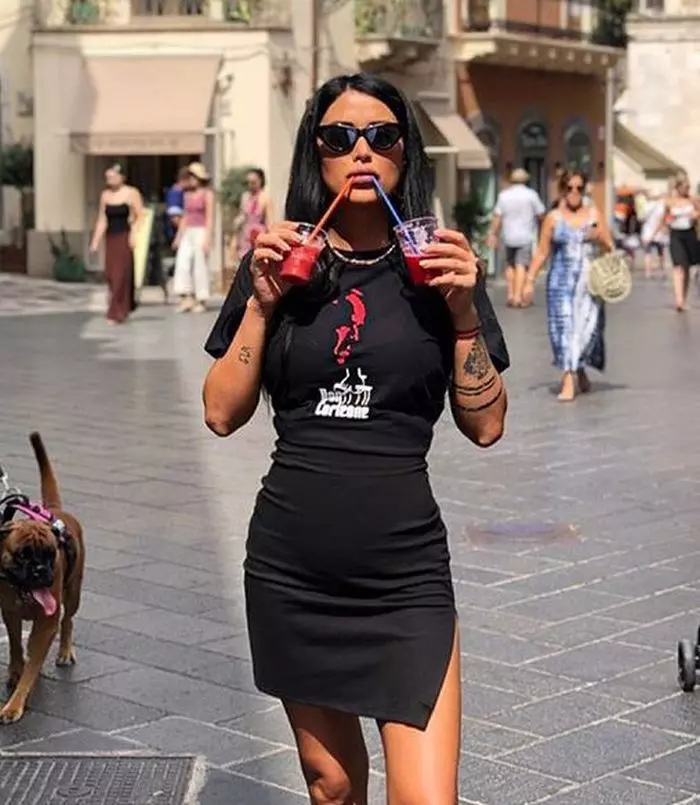 Daniela Crudu și-a schimbat implanturile mamare