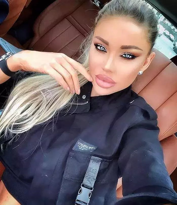 bianca-dragusanu-interventie-estetica-1