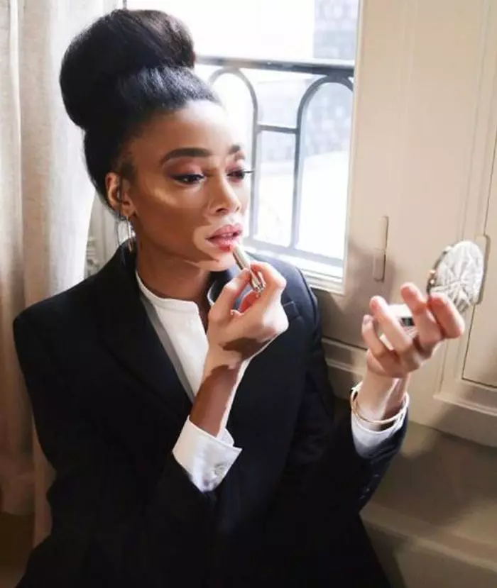 Winnie Harlow, cel mai frumos model cu vitiligo