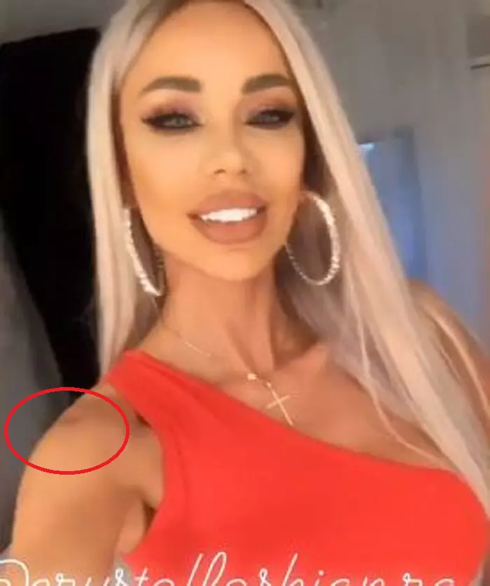 Bianca Drăgușanu, după ce ar fi fost bătută de Alex Bodi