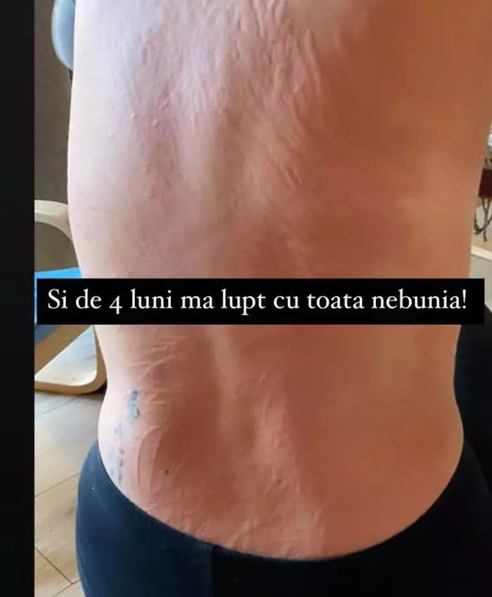 Erupția Addei