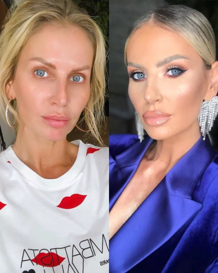 Andreea-Banica-operatii-2