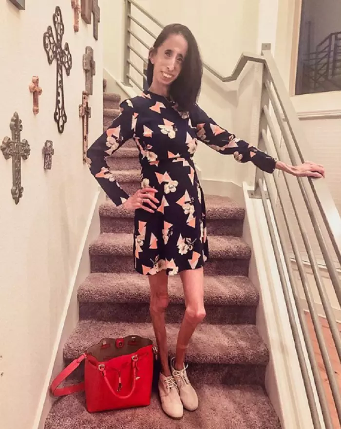 Lizzie Velasquez