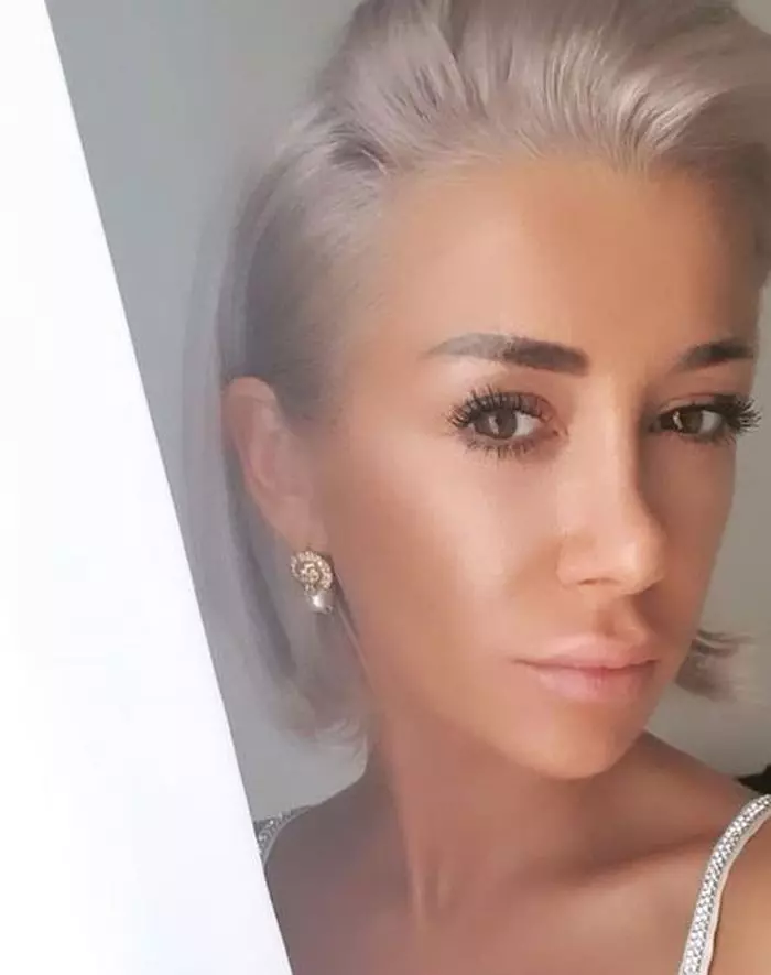 Raluca Tănase, o nouă intervenție estetică