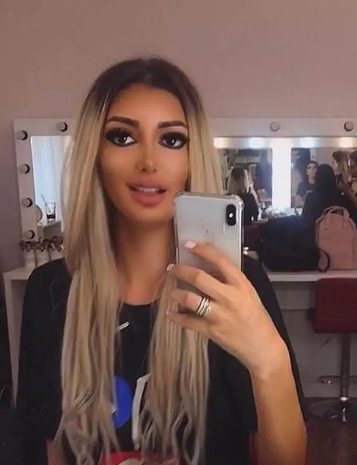 Lorena Tonciu, după intervențiile estetice