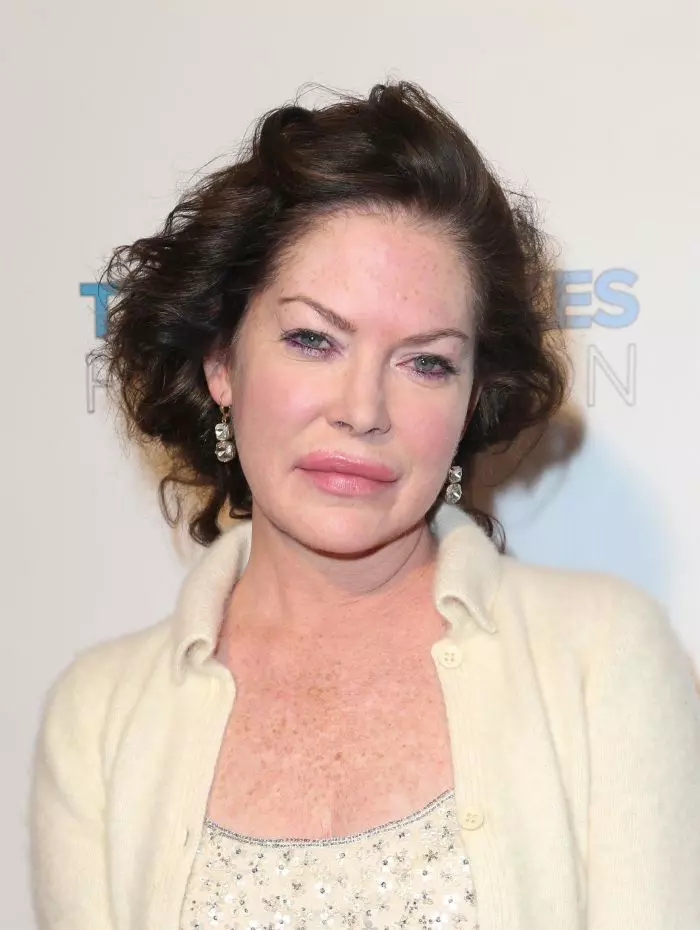 Lara nu a recunoscut niciodată că ar fi apelat la bisturiu