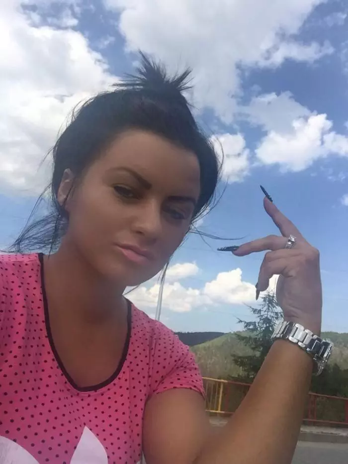 Carmen-de-la-Salciua-inainte-de-operatiile-estetice-6