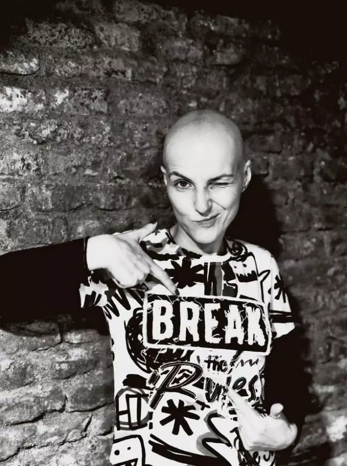 Chris Simion în perioada tratamentului