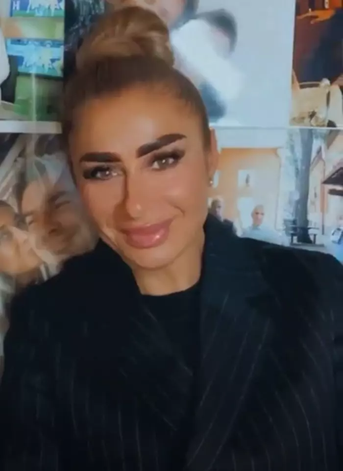 Anamaria Prodan intervenție estetică față