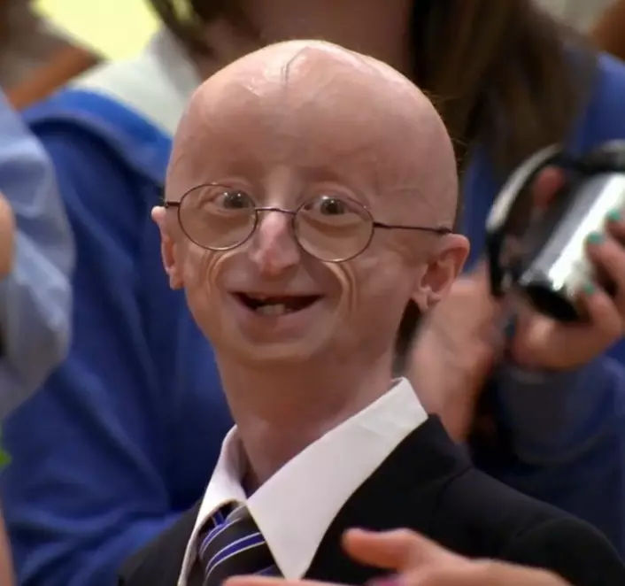 progeria12.jpg