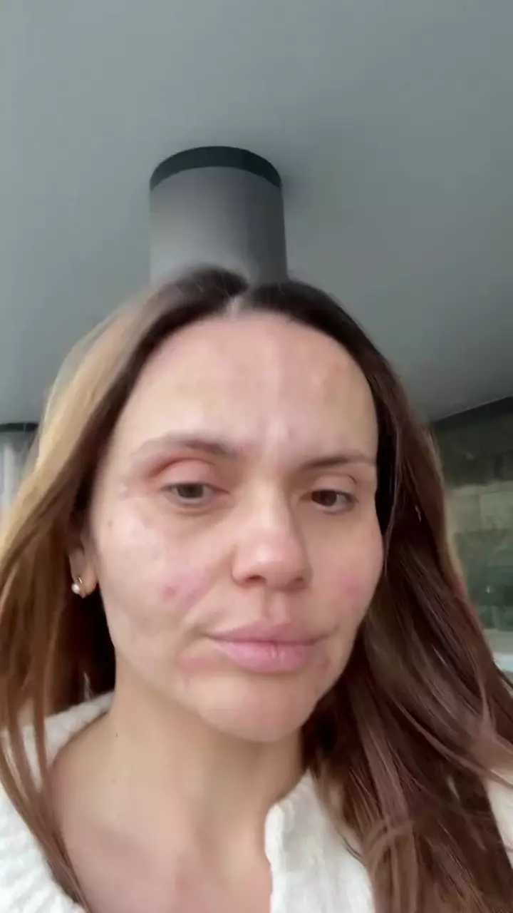 Cristina Șișcanu și-a făcut cadou o intervenție estetică înainte de aniversarea de 40 de ani (1)