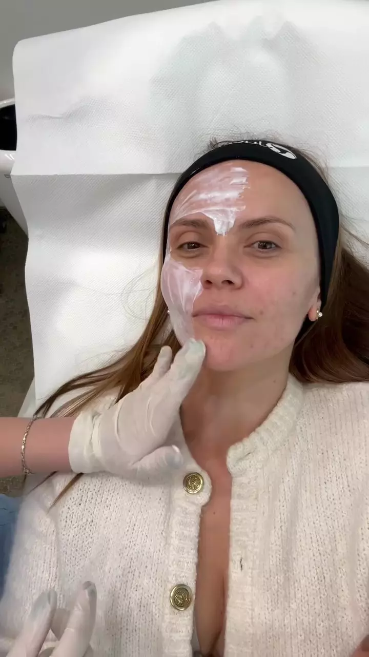 Cristina Șișcanu și-a făcut cadou o intervenție estetică înainte de aniversarea de 40 de ani (10)