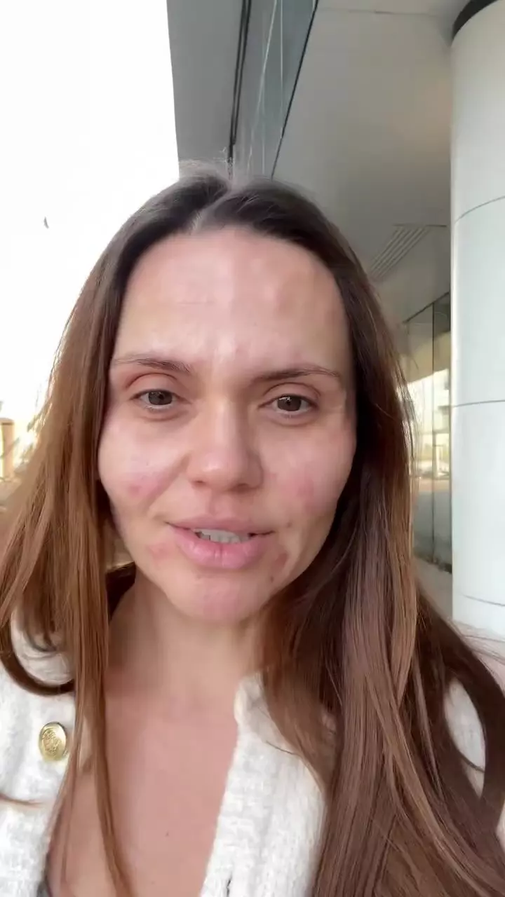 Cristina Șișcanu și-a făcut cadou o intervenție estetică înainte de aniversarea de 40 de ani (11)
