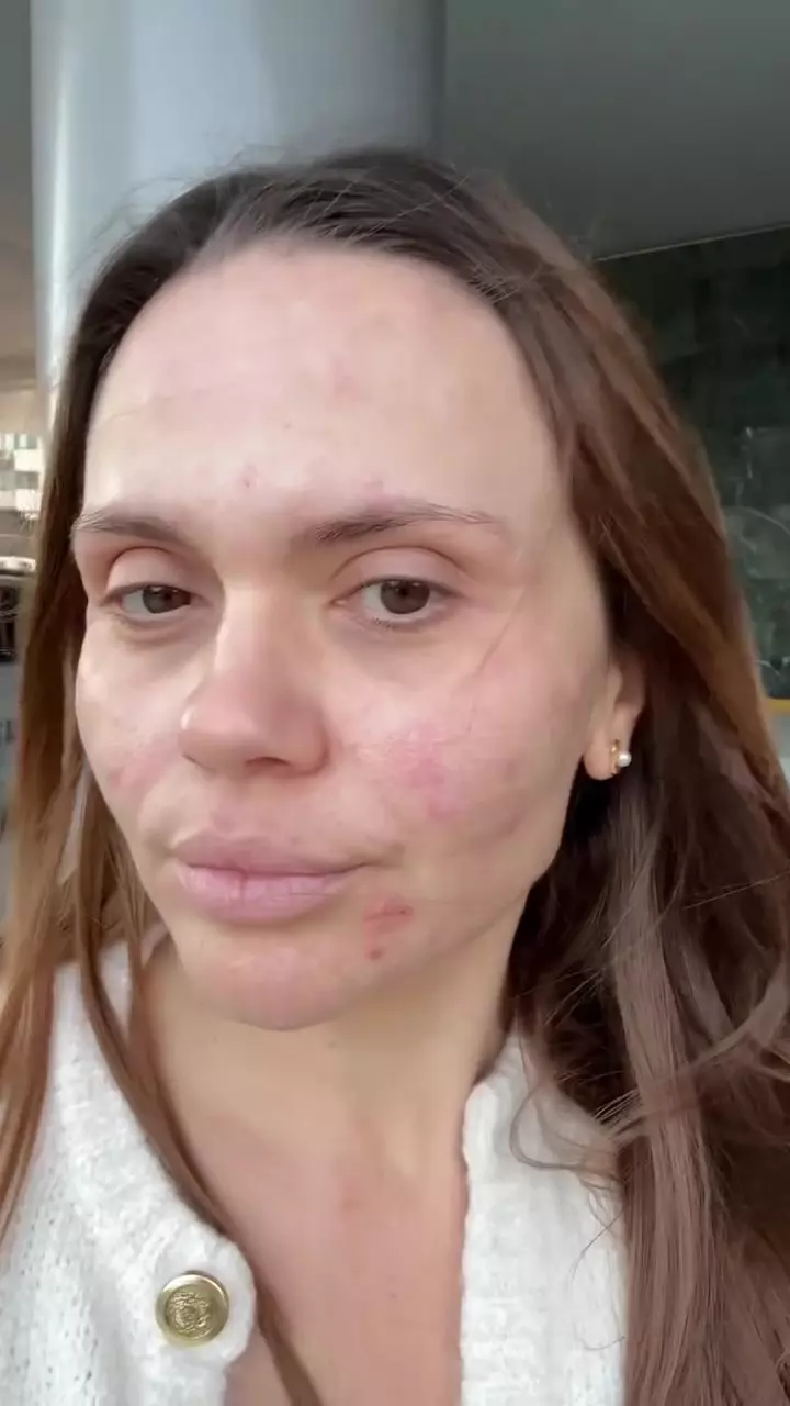 Cristina Șișcanu și-a făcut cadou o intervenție estetică înainte de aniversarea de 40 de ani (2)