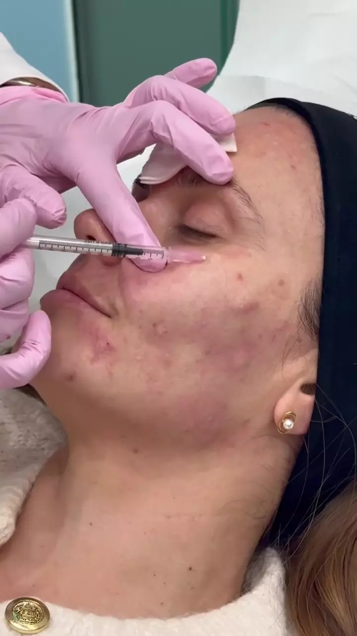 Cristina Șișcanu și-a făcut cadou o intervenție estetică înainte de aniversarea de 40 de ani (3)