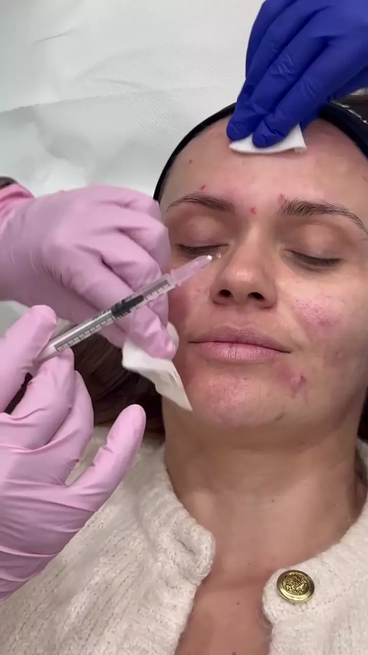 Cristina Șișcanu și-a făcut cadou o intervenție estetică înainte de aniversarea de 40 de ani (4)