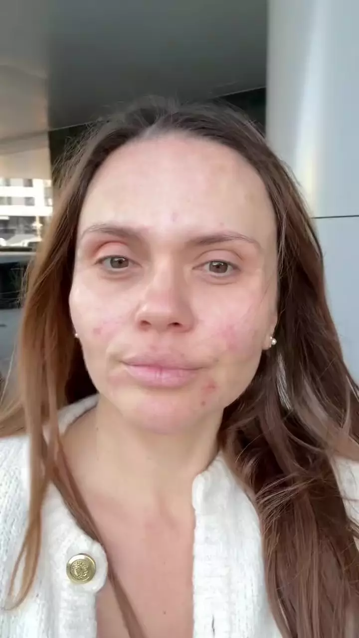Cristina Șișcanu și-a făcut cadou o intervenție estetică înainte de aniversarea de 40 de ani (8)