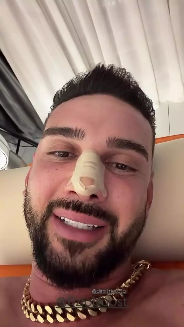 Dorian Popa după operația la nas (5)
