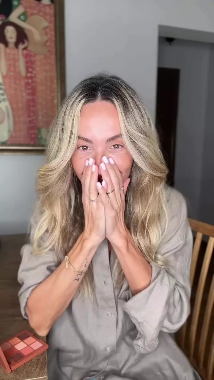 Flavia Mihășan după operația la nas (5)