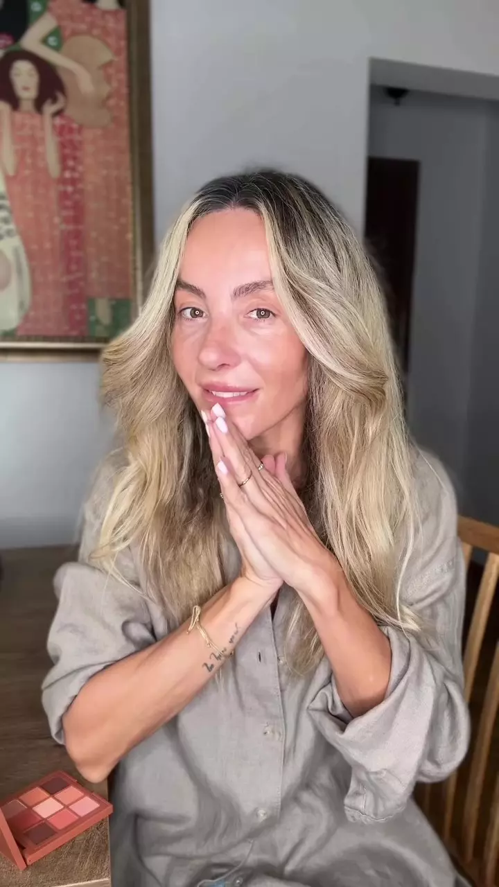 Flavia Mihășan după operația la nas (6)