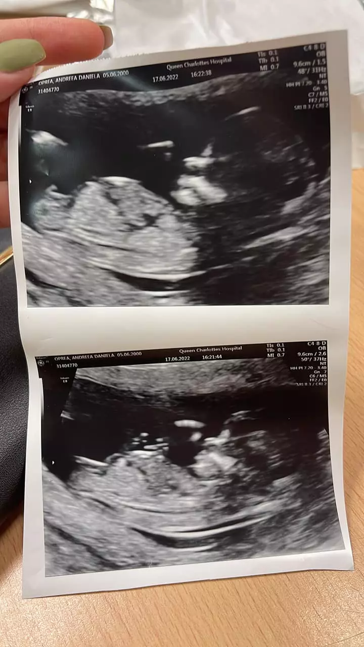 andreea mireasa insarcinata