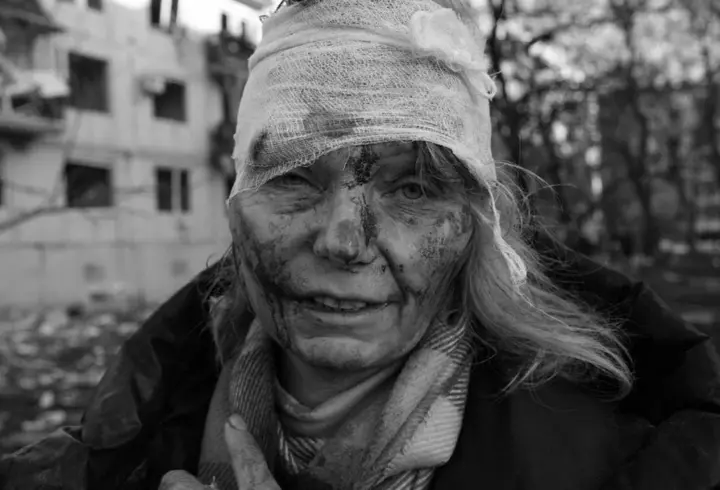 De unde provine cicatricea imensă de pe abdomenul lui Marian Drăgulescu de la Survivor. A trecut printr-o mare cumpănă!