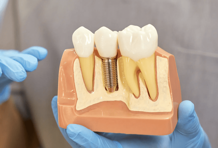 Clasificarea tensiometrelor și sfaturi pentru măsurarea corectă a tensiunii