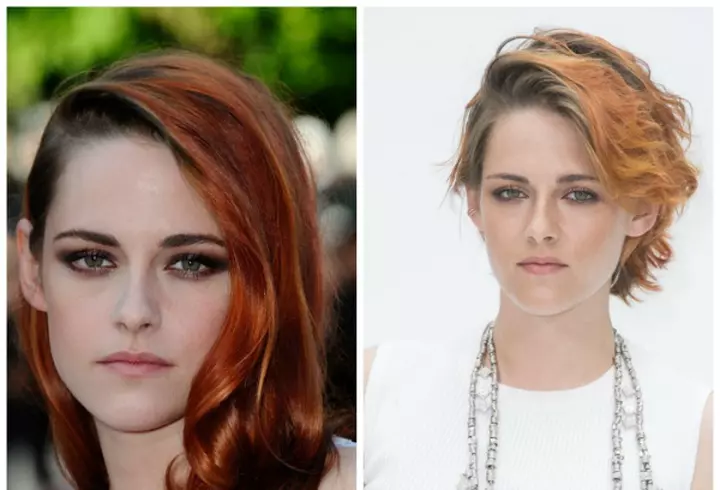 5 vedete cu operaţii estetice la vârste fragede  