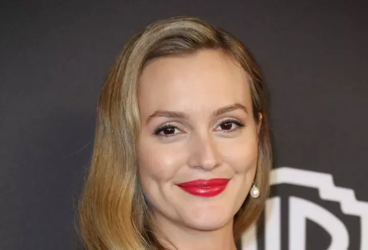 2 remedii rapide pentru arsurile solare