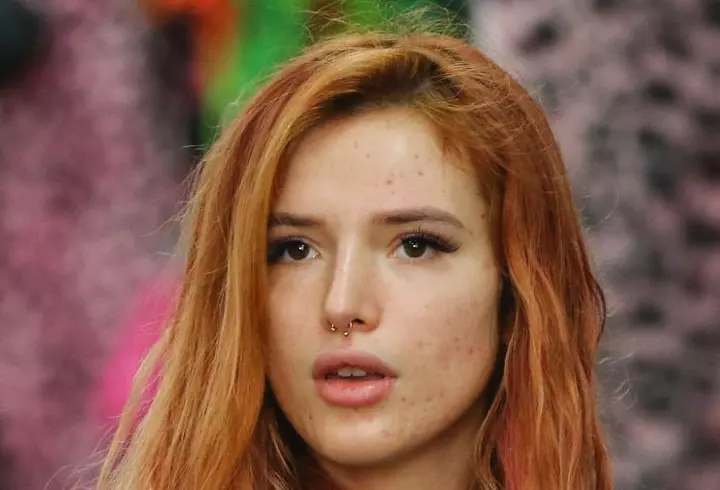 2 remedii rapide pentru arsurile solare