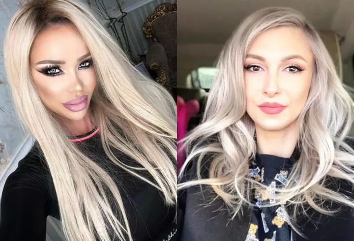 Florin Călinescu a fost diagnosticat cu cancer de piele: "Timp de 3 luni am avut nasul triplu"