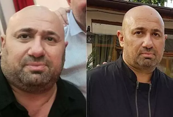 Florin Călinescu a fost diagnosticat cu cancer de piele: "Timp de 3 luni am avut nasul triplu"