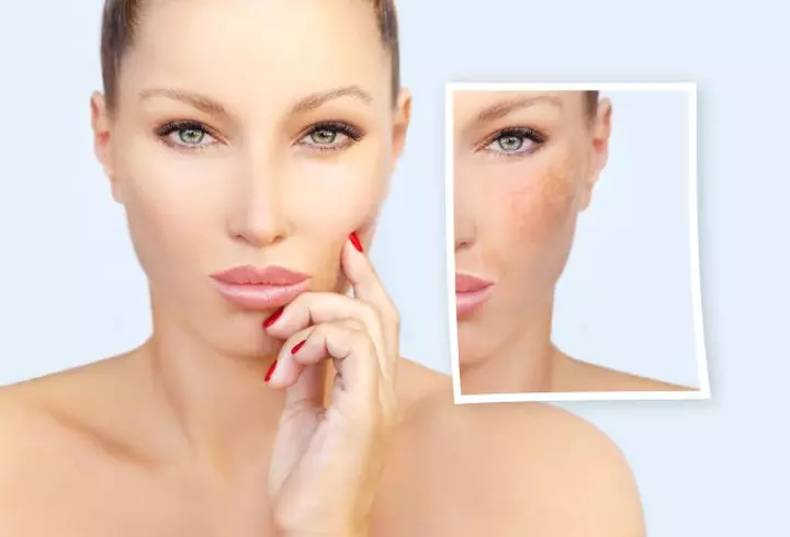 (P) FOREO lansează LUNA 3 pentru împrospătarea, hidratarea și tonifierea tenului tău