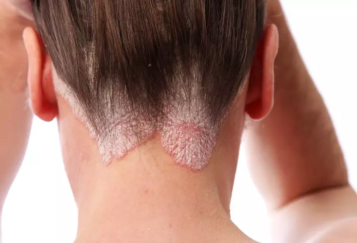 De ce nu simți nicio chimie când te săruți cu unele persoane