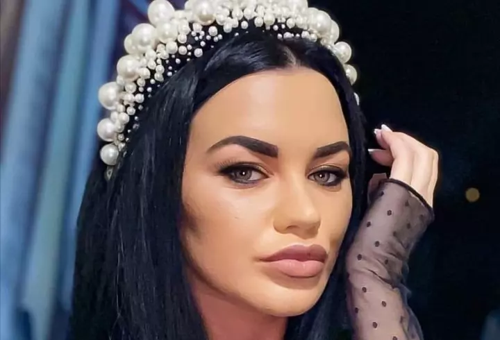 Andreea Mantea şi-a făcut o nouă intervenţie estetică, iar fanii au criticat-o imediat: „Arătai mai bine înainte!”