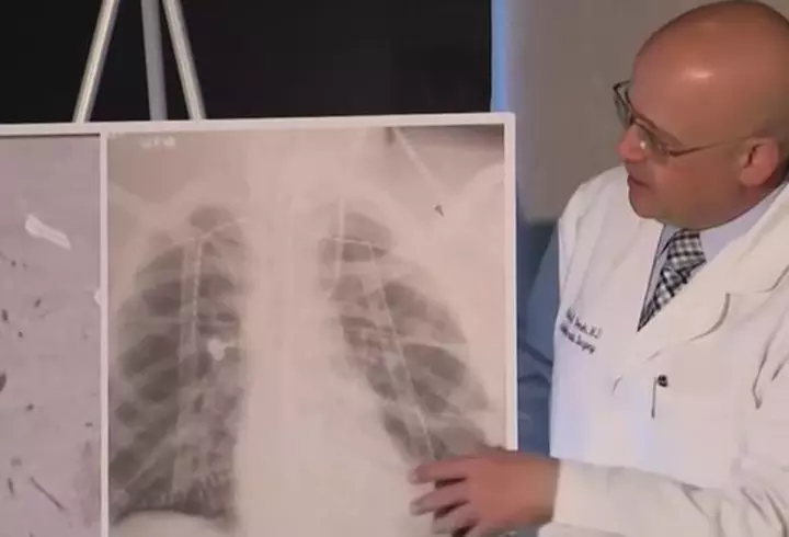 Trecerea la ora de vară și efectele resimțite de organism. Ce se întâmplă cu persoanele în vârstă, depresive sau anxioase