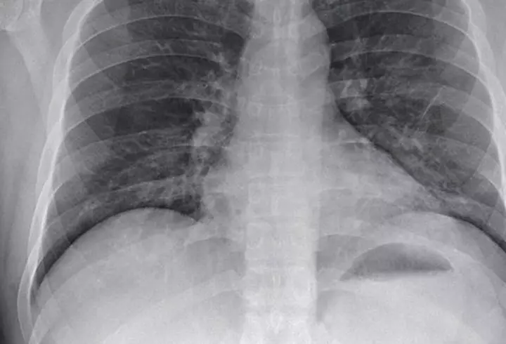 S-a cuplat Alex Bodi cu altă femeie, înainte de divorț? Primele declarații despre rusoaica Daria: „Am cunoscut-o din întâmplare!”