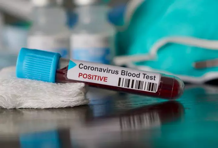 Caz revoltător la un hotel din Mamaia, unde se află în carantină 523 de oameni: mâncare expirată, pusă în vase pline cu mucegai