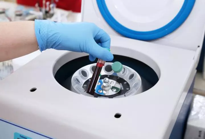 Încă un medic din România a murit de COVID-19. Profesorul Istvan Benedek a fost primul medic român care a efectuat un transplant de măduvă la un adult