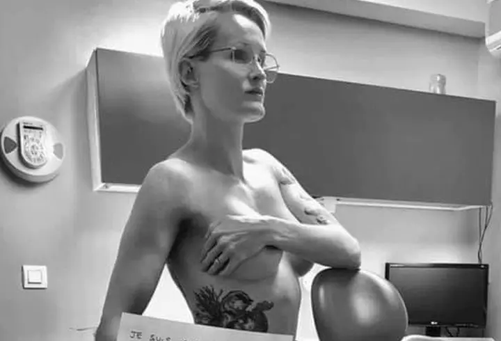 Coronavirusul produce 5 tipuri de iritații ale pielii, care i-au șocat pe medici. Ce înseamnă "Degetul COVID" și cum arată