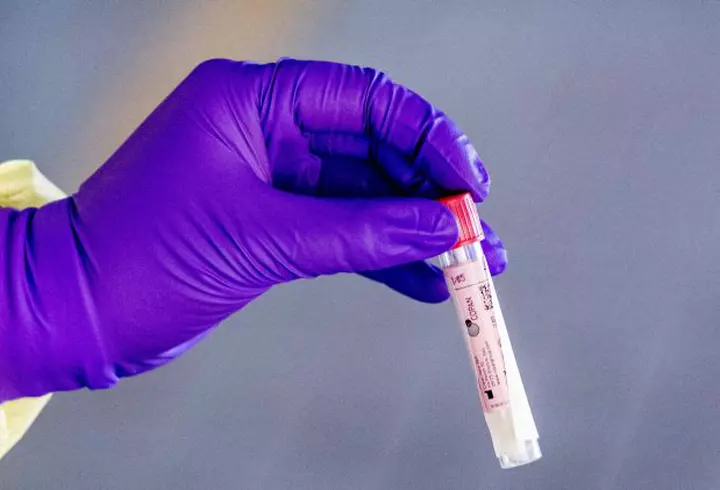 Un medic pneumolog ne învață cum să ne igienizăm nasul și gâtul acasă, pentru a preîntâmpina infectarea cu COVID-19. Atenție: unele remedii naturiste cresc șansele de a contacta virusul!