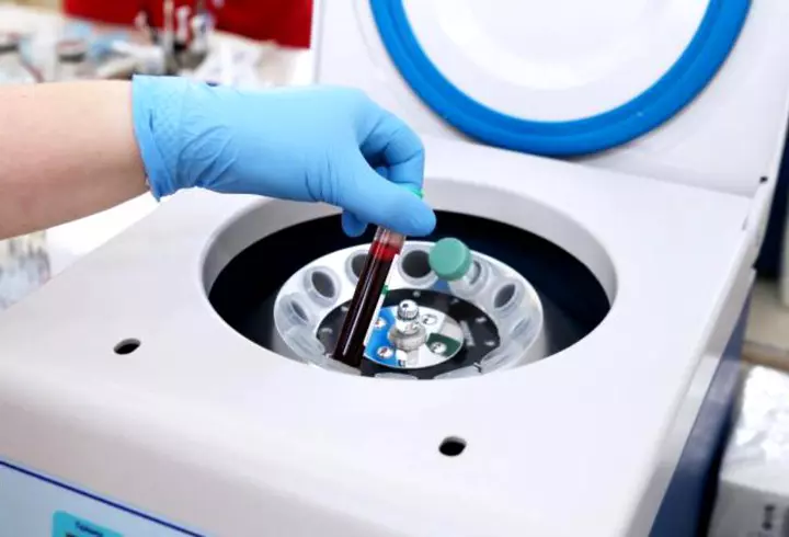 Organizaţia Mondială a Sănătăţii NU crede în apariția celui de-al doilea val COVID-19: "Virusul va avea dificultăţi să supravieţuiască". Îndemnul OMS către populație